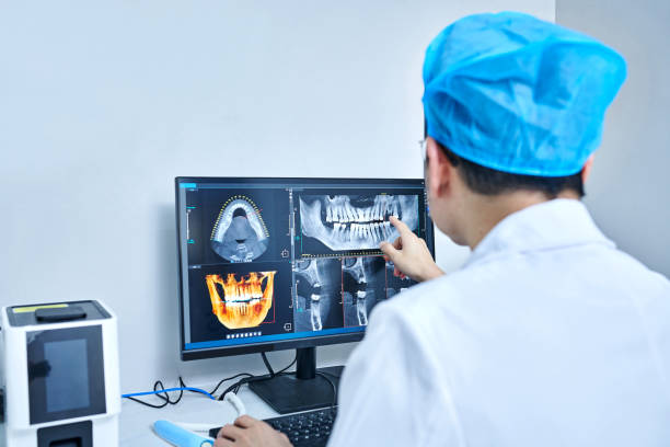 Best Emergency Wisdom Teeth Removal in Newport, TN