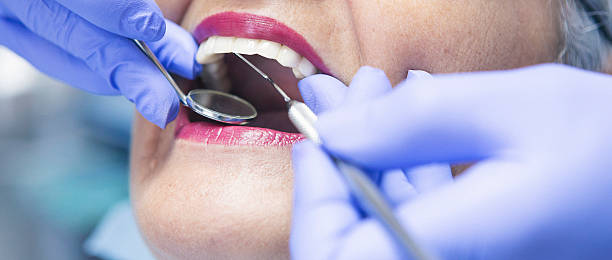 Best Emergency Tooth Extraction in Newport, TN